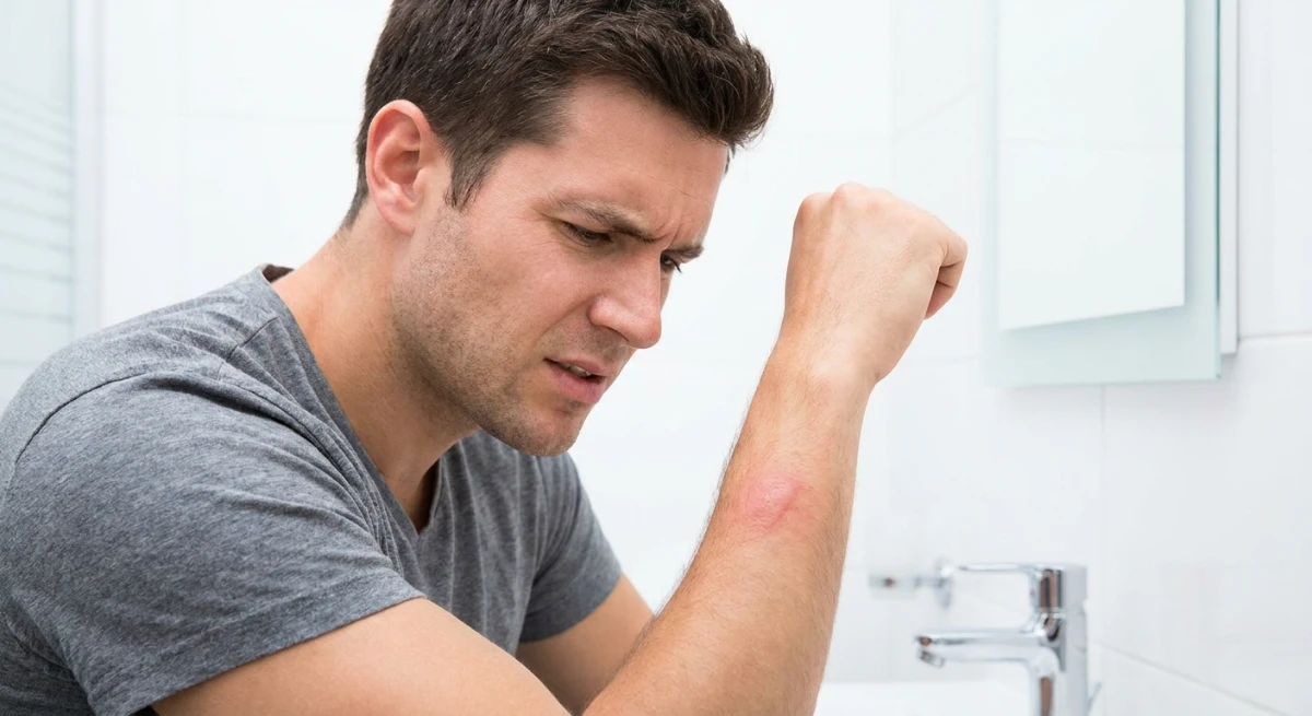 Person checking spider bite symptoms on their arm